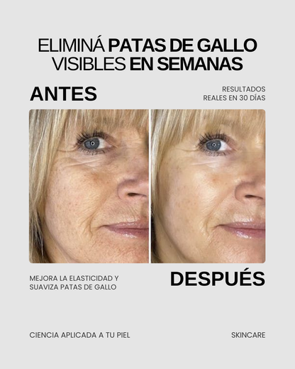 LIFTER 3D — Crema Tensora con Efecto Lifting | Firmeza, Arrugas y Papada