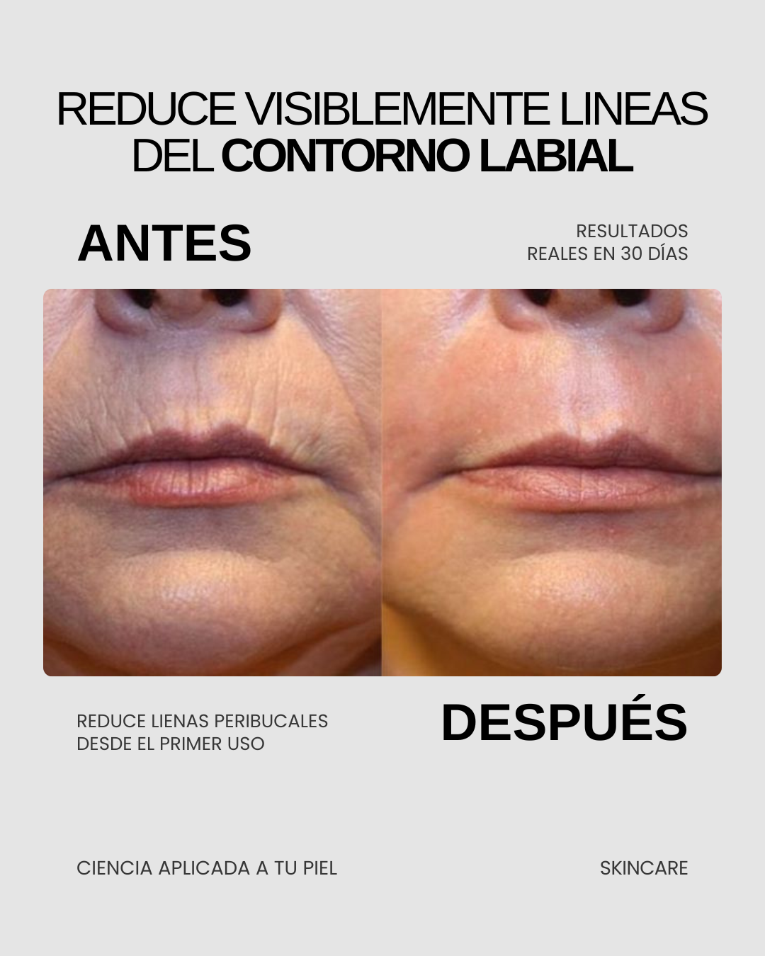 LIFTER 3D — Crema Tensora con Efecto Lifting | Firmeza, Arrugas y Papada