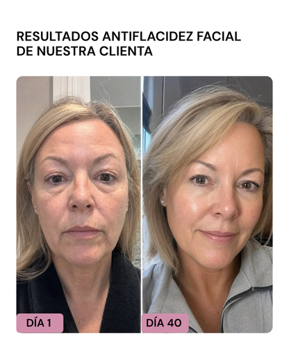 LIFTER 3D – Crema Tensora Efecto Botox, Antiarrugas, Antiflacidez y Reafirmante