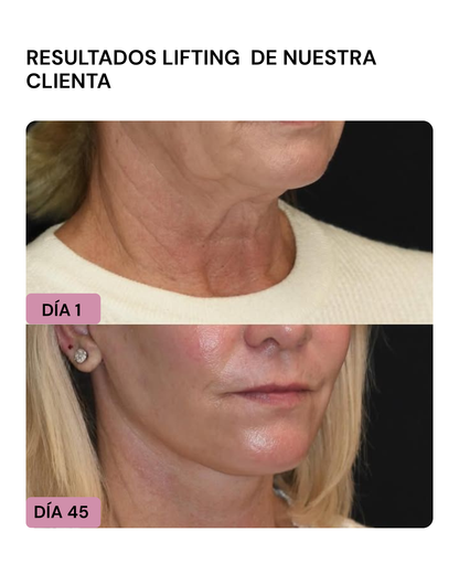 LIFTER 3D – Crema Tensora Efecto Botox, Antiarrugas, Antiflacidez y Reafirmante