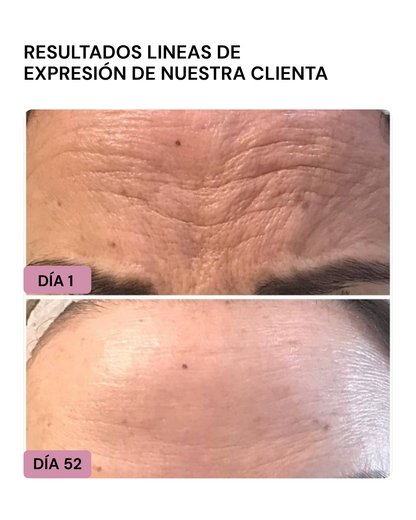 LIFTER 3D – Crema Tensora Efecto Botox, Antiarrugas, Antiflacidez y Reafirmante