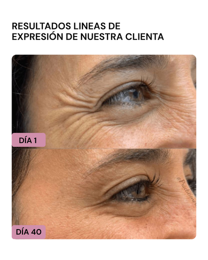 LIFTER 3D – Crema Tensora Efecto Botox, Antiarrugas, Antiflacidez y Reafirmante