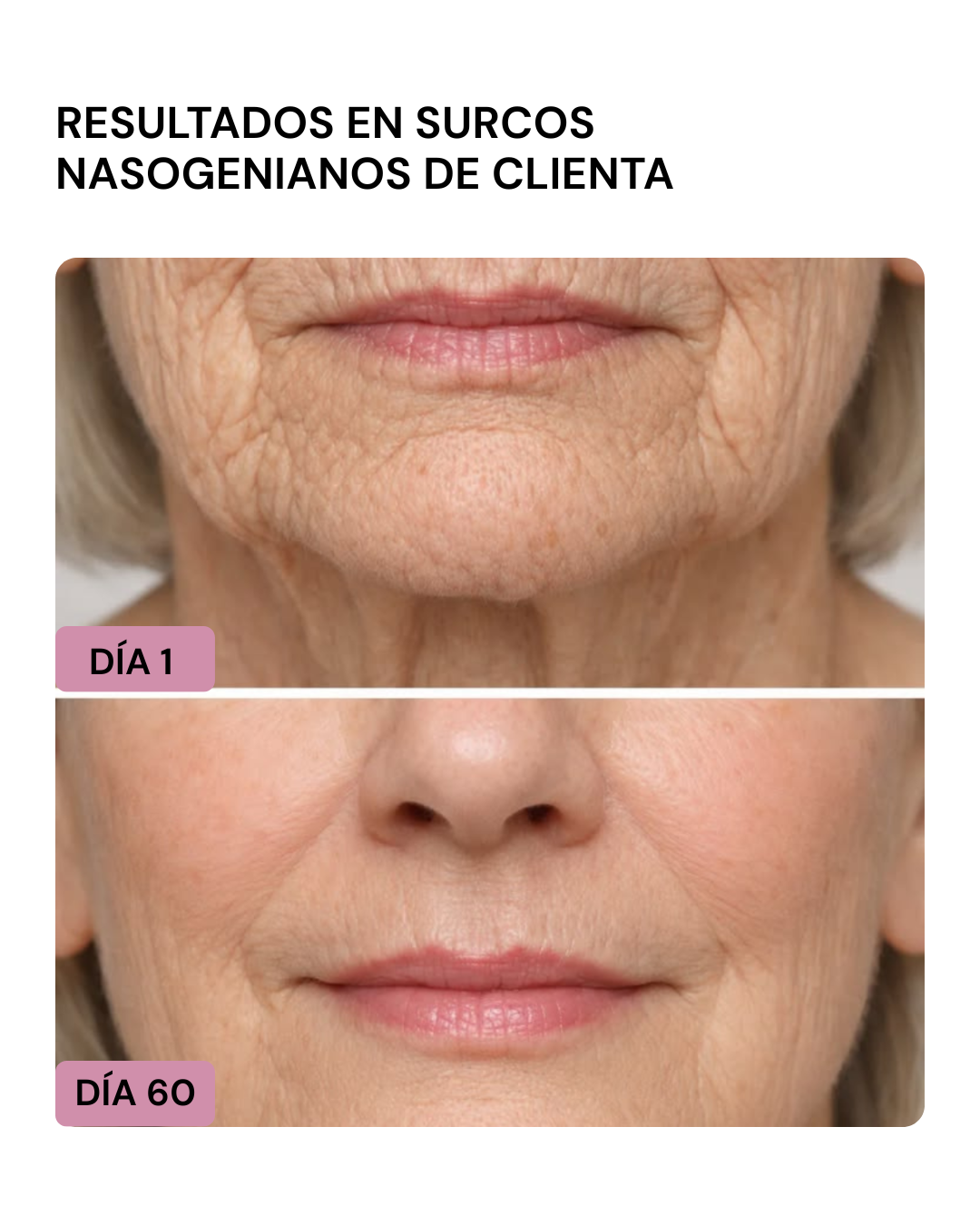 LIFTER 3D – Crema Tensora Efecto Botox, Antiarrugas, Antiflacidez y Reafirmante