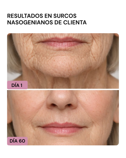 LIFTER 3D – Crema Tensora Efecto Botox, Antiarrugas, Antiflacidez y Reafirmante