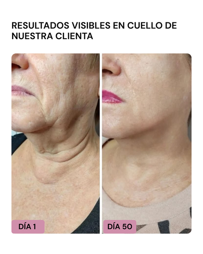 LIFTER 3D – Crema Tensora Efecto Botox, Antiarrugas, Antiflacidez y Reafirmante