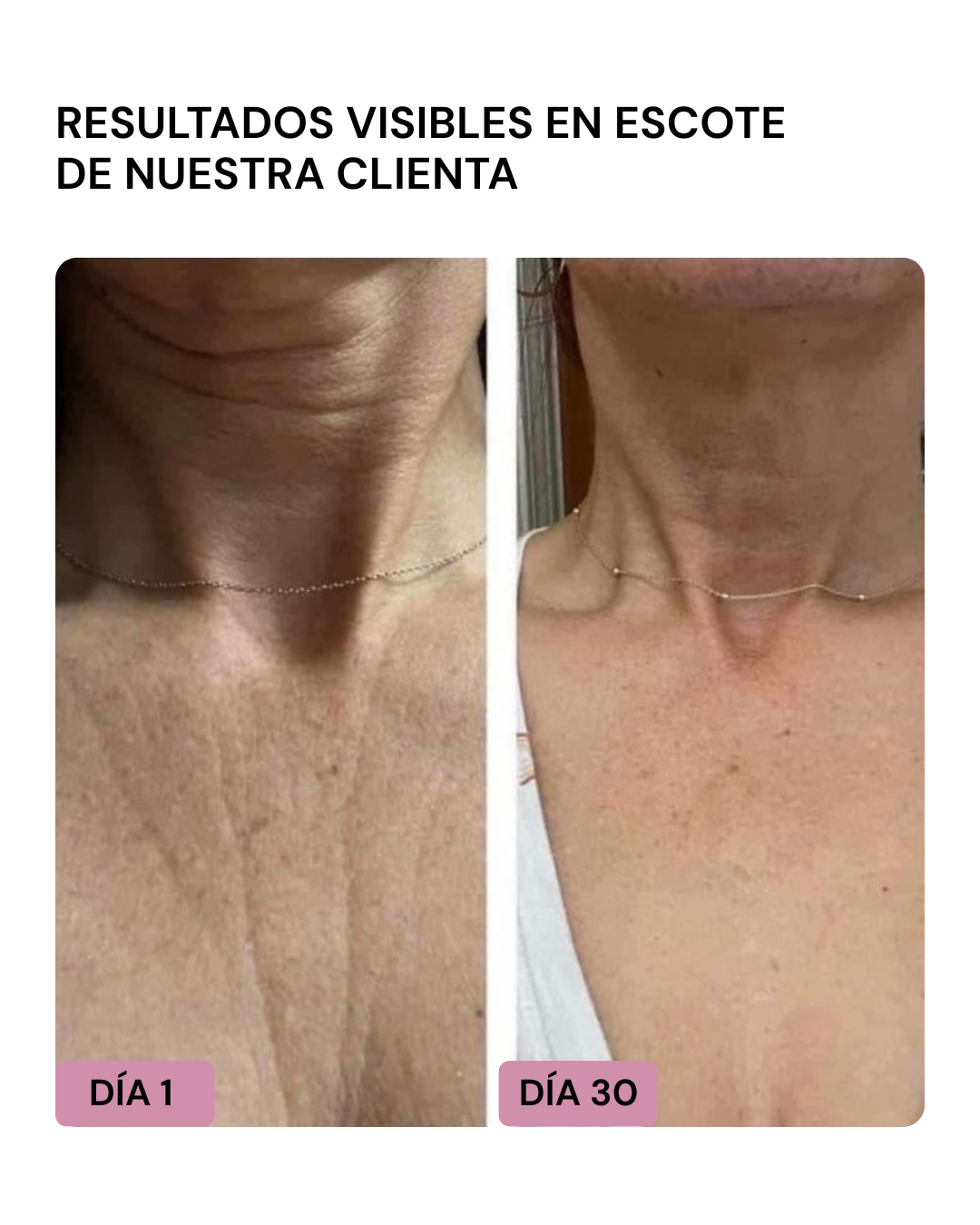 LIFTER 3D – Crema Tensora Efecto Botox, Antiarrugas, Antiflacidez y Reafirmante