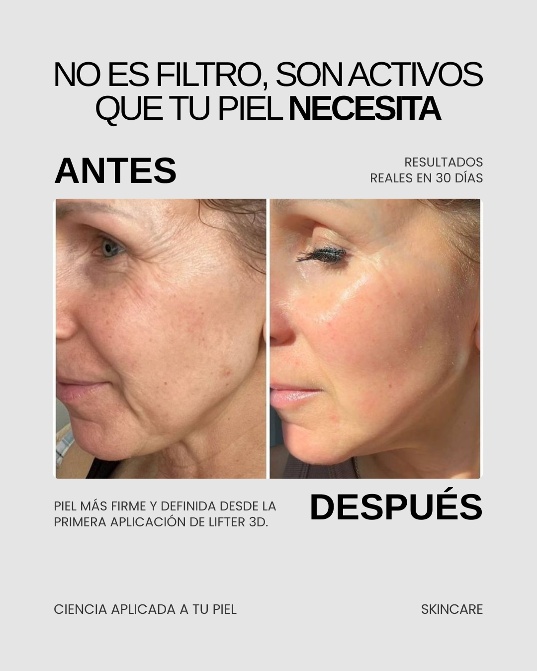LIFTER 3D — Crema Tensora con Efecto Lifting | Firmeza, Arrugas y Papada