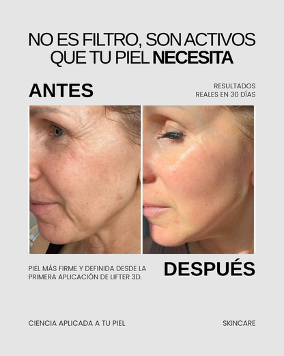 LIFTER 3D — Crema Tensora con Efecto Lifting | Firmeza, Arrugas y Papada