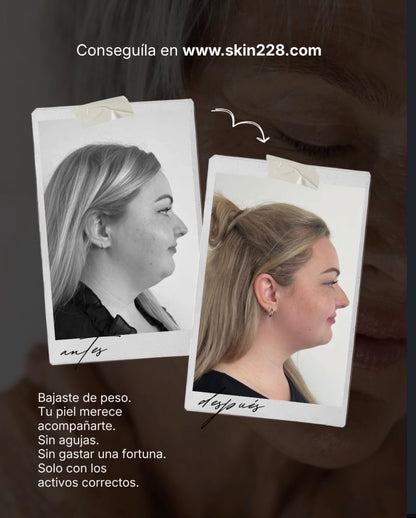 LIFTER 3D — Crema Tensora con Efecto Lifting | Firmeza, Arrugas y Papada